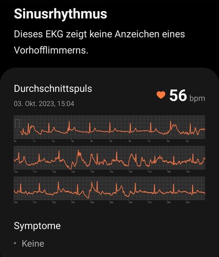 Screenshot_20231025_173430_Samsung Health Monitor.jpg