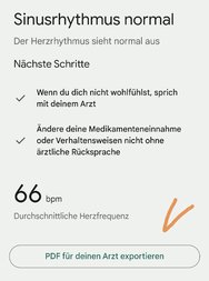 Screenshot_20241019_114152_com_fitbit_FitbitMobile_WebFrameActivity.jpg