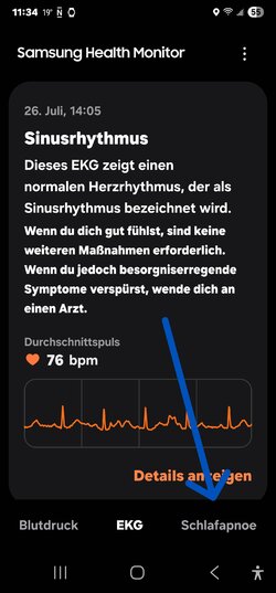 Screenshot_20250801_113419_Samsung Health Monitor.jpg
