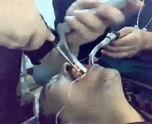 ezgif-2966248878.gif