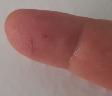 _Finger.jpg