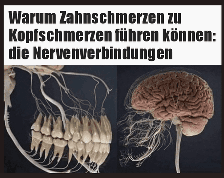 üpojp (12).png