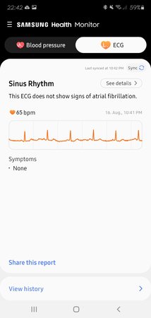 EKG_Handy.jpg