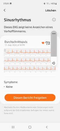 Screenshot_20220818-172248_Samsung Health Monitor.jpg