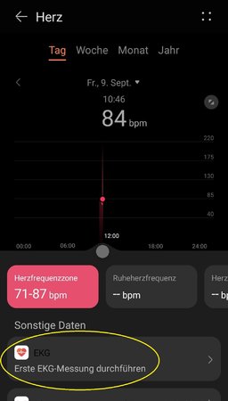 Health 12.1.8.310  _EKG.jpg