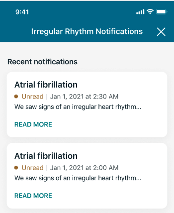 irregular rhythm notification - history.png
