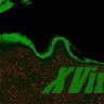 XVirus